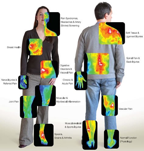 Thermography Scan